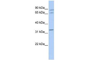 GJA4 antibody used at 1 ug/ml to detect target protein. (GJA4 抗体  (Middle Region))