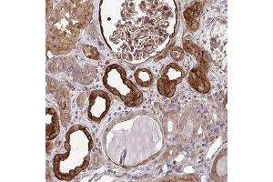 Immunohistochemical staining of human kidney with TRIP6 polyclonal antibody  shows strong cytoplasmic and membranous positivity in cells in tubules and cells in glomeruli at 1:50-1:200 dilution. (TRIP6 抗体)