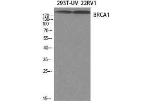 Western Blot analysis of 293T-UV, 22RV1 cells using BRCA1 Polyclonal Antibody at dilution of 1:1000. (BRCA1 抗体)