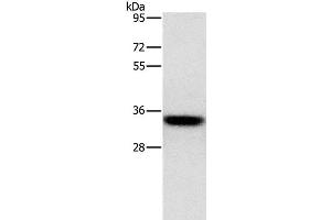 Western Blot analysis of PC3 cell using HOXB13 Polyclonal Antibody at dilution of 1:800 (HOXB13 抗体)