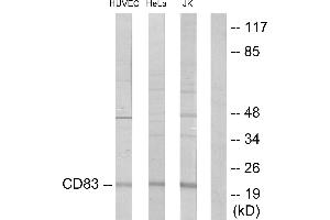 Immunohistochemistry analysis of paraffin-embedded human lung carcinoma tissue using CD83 antibody. (CD83 抗体)