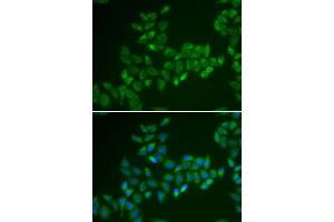 Immunofluorescence analysis of HeLa cells using CRAT antibody (ABIN5973772). (CRAT 抗体)