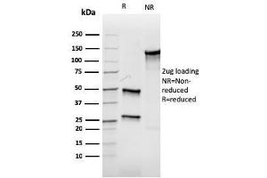 SDS-PAGE Analysis Purified Aurora B Recombinant Mouse Monoclonal Antibody (rAURKB/1592). (Recombinant Aurora Kinase B 抗体  (AA 89-251))