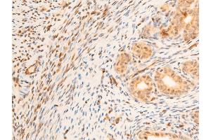 ABIN6267218 at 1/100 staining rat uterine tissue sections by IHC-P. (SGK1 抗体  (pSer422))