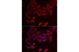 Immunofluorescence analysis of A549 cells using FLCN antibody (ABIN5973885). (FLCN 抗体)