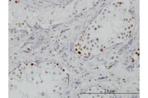 Immunoperoxidase of monoclonal antibody to BRD3 on formalin-fixed paraffin-embedded human testis. (BRD3 抗体  (AA 418-556))