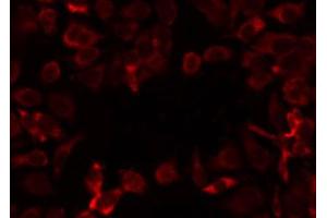 ABIN6274728 staining COLO205 by IF/ICC. (MRPL12 抗体  (Internal Region))