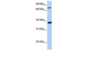 Image no. 1 for anti-Death Inducer-Obliterator 1 (DIDO1) (AA 480-529) antibody (ABIN6737879) (DIDO1 抗体  (AA 480-529))