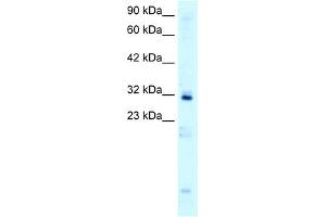 WB Suggested Anti-HOXB9 Antibody Titration:  0. (HOXB9 抗体  (N-Term))