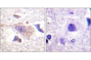 Immunohistochemistry analysis of paraffin-embedded human brain tissue, using GRB10 (Ab-67) Antibody. (GRB10 抗体  (AA 33-82))