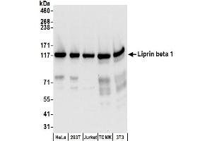 anti-PTPRF Interacting Protein, Binding Protein 1 (Liprin beta 1) (PPFIBP1) (AA 175-225) antibody