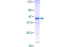 Image no. 1 for Male Enhanced Antigen 1 (MEA1) (AA 1-185) protein (GST tag) (ABIN1310616) (MEA1 Protein (AA 1-185) (GST tag))