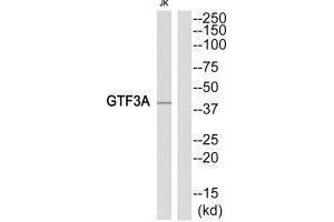 Western blot analysis of extracts from Jurkat cells, using GTF3A antibody. (GTF3A 抗体)