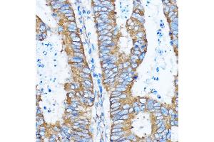 Immunohistochemistry (IHC) image for anti-Y Box Binding Protein 1 (YBX1) (AA 100-200) antibody (ABIN6150328)