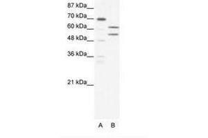 Image no. 1 for anti-Zinc Finger and BTB Domain Containing 43 (ZBTB43) (AA 151-200) antibody (ABIN202596) (ZBTB43 抗体  (AA 151-200))