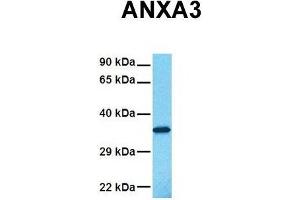 Host:  Rabbit  Target Name:  ANXA3  Sample Tissue:  Human Fetal Lung  Antibody Dilution:  1. (Annexin A3 抗体  (N-Term))