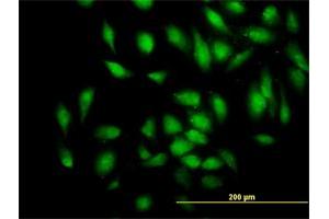 Immunofluorescence of monoclonal antibody to PDE4DIP on HeLa cell.