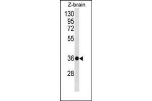 Western blot analysis of HOXD10 Antibody (C-term) in Zebrafish brain tissue lysates (35ug/lane). (HOXD10 抗体  (C-Term))