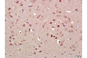 Paraformaldehyde-fixed, paraffin embedded rat brain, Antigen retrieval by boiling in sodium citrate buffer (pH6. (SNCA 抗体  (AA 51-90))