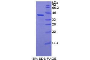 SDS-PAGE analysis of Rat C3a Protein. (C3a 蛋白)