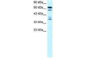 ZNF512 antibody used at 0. (ZNF512 抗体  (Middle Region))