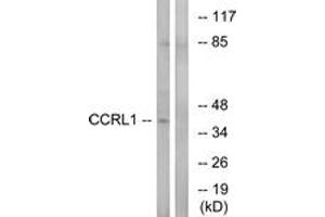 Western blot analysis of extracts from HepG2 cells, using CCRL1 Antibody.