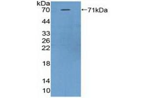 Detection of Recombinant ASPN, Mouse using Polyclonal Antibody to Asporin (ASPN) (Asporin 抗体  (AA 16-373))