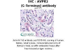 Image no. 1 for anti-Arginine Vasopressin Receptor 2 (AVPR2) (C-Term) antibody (ABIN1732154) (AVPR2 抗体  (C-Term))