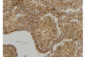 ABIN6279564 at 1/100 staining  testis tissue by IHC-P. (MYO3B 抗体  (C-Term))