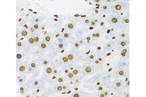 Immunohistochemistry (Paraffin-embedded Sections) (IHC (p)) image for anti-KH Domain Containing, RNA Binding, Signal Transduction Associated 1 (KHDRBS1) antibody (ABIN7261952)