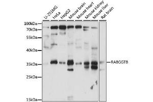 Western blot analysis of extracts of various cell lines, using RABGGTB antibody. (RABGGTB 抗体)