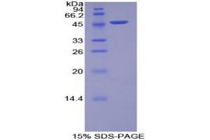 SDS-PAGE analysis of Rat MYL6B Protein.