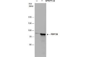 WB Image PRPF39 antibody detects PRPF39 protein by western blot analysis.
