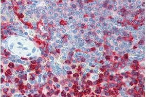 Immunohistochemistry staining of human spleen (paraffin sections) using anti-CD18 (MEM-48). (Integrin beta 2 抗体)