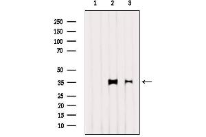 Western blot analysis of extracts from various samples, using LDHA  Antibody. (Lactate Dehydrogenase A 抗体  (C-Term))