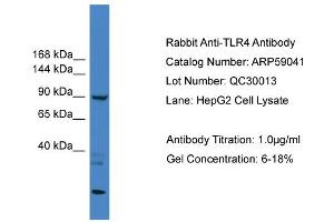 WB Suggested Anti-TLR4  Antibody Titration: 0. (TLR4 抗体  (Middle Region))