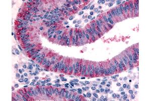 Anti-DKK1 antibody IHC of human uterus, endometrium. (DKK1 抗体  (N-Term))