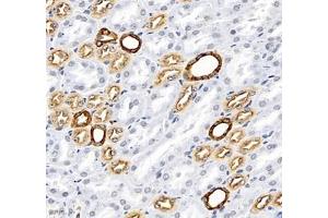 Immunohistochemistry (Paraffin-embedded Sections) (IHC (p)) image for anti-Mal, T Cell Differentiation Protein 2 (MAL2) antibody (ABIN7074549)