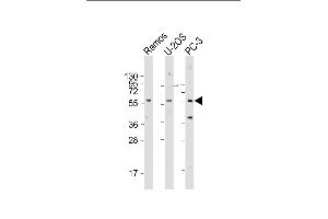 TRIM6 Antibody (N-term) (ABIN1881902 and ABIN2843419) western blot analysis in 293,A549,Ramos cell line lysates (35 μg/lane). (TRIM6 抗体  (N-Term))