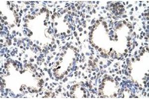 Immunohistochemical staining (Formalin-fixed paraffin-embedded sections) of human lung with FLJ12529 polyclonal antibody  at 4-8 ug/mL working concentration. (CPSF7 抗体  (C-Term))