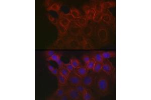 Immunofluorescence analysis of  cells using EpCAM Rabbit pAb (ABIN3021637, ABIN3021638, ABIN3021639, ABIN1513585 and ABIN6215463) at dilution of 1:100 (40x lens).
