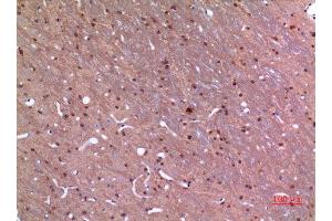 Immunohistochemistry (IHC) image for anti-GDP Dissociation Inhibitor 2 (GDI2) (C-Term) antibody (ABIN3187833)