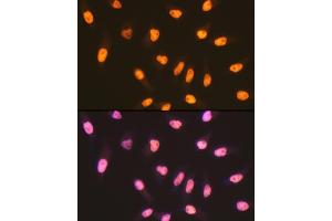 Immunofluorescence analysis of HeLa cells using MSH6 Rabbit mAb (ABIN7268709) at dilution of 1:100 (40x lens).