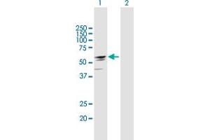 Western Blot analysis of EFHA2 expression in transfected 293T cell line by EFHA2 MaxPab polyclonal antibody. (EFHA2 抗体  (AA 1-530))