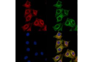 ABIN7094769 and ABIN7098820 staining HepG2 cells by IF/ICC. (PRMT3 抗体  (Internal Region))