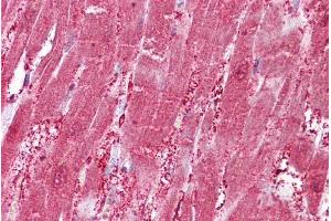 Immunohistochemistry (IHC) image for anti-Cysteine and Glycine-Rich Protein 3 (CSRP3) (Internal Region) antibody (ABIN334380)