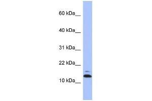 WB Suggested Anti-ASAH1 Antibody Titration: 0. (ASAH1 抗体  (N-Term))