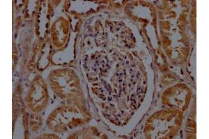 Immunohistochemistry (IHC) image for anti-Succinate Dehydrogenase Complex, Subunit B, Iron Sulfur (Ip) (SDHB) (AA 29-280) antibody (ABIN7170890)
