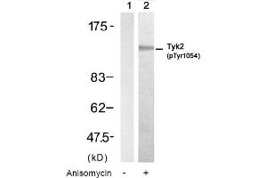 Image no. 1 for anti-Tyrosine Kinase 2 (TYK2) (pTyr1054) antibody (ABIN319229) (TYK2 抗体  (pTyr1054))
