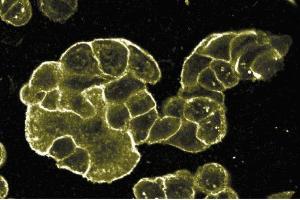 Immunofluorescent staining of WIDR cells at 1:50 dilution of E-cadherin. (E-cadherin 抗体  (C-Term))